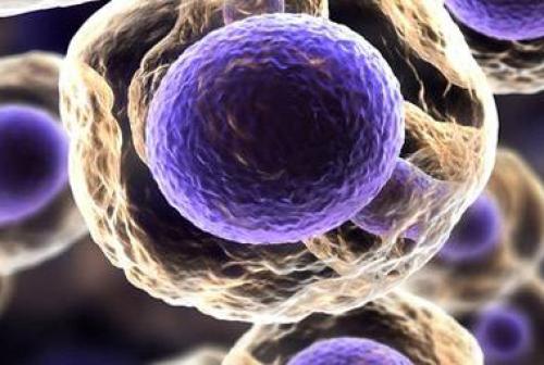 Lenf kanseri Lenfoma